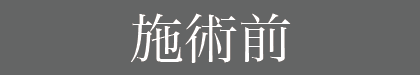 施術前