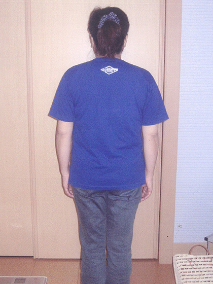施術後